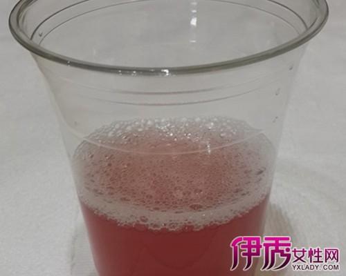 【图】告诉你血尿的颜色? 血尿的鉴别与护理!