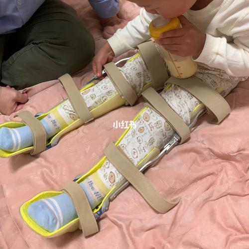 3岁宝宝膝外翻支具矫正记录_平衡车_小朋友_骑行_母婴