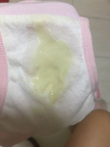 这个是羊水么.刚刚一下子流出来的