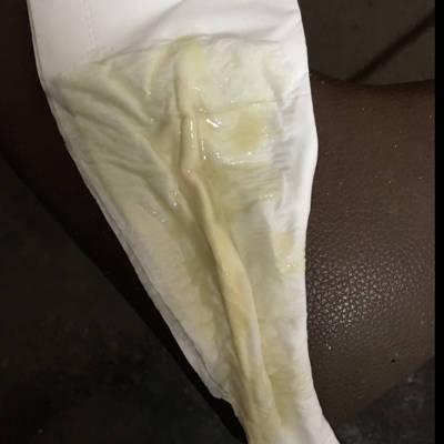 怀孕35周零1天这个是羊水么?求解答. 各位宝妈们