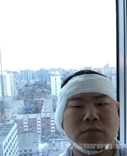 石家庄丰益肛泰医院真的好吗 纷飞的雪花与痔疮不期而