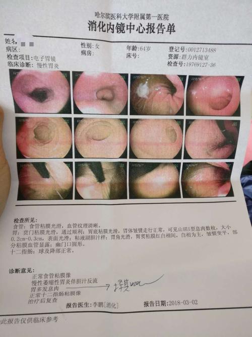 慢性萎缩性胃炎可以完全治愈吗?