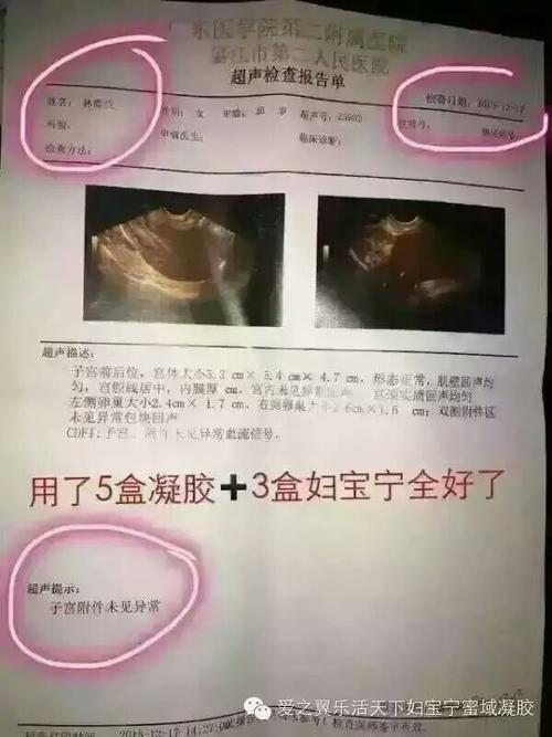 宫颈纳氏囊肿案例!