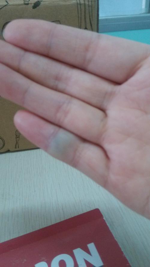 你好,我的右手无名指上长了一个小包,一碰就会疼,已经有半年了