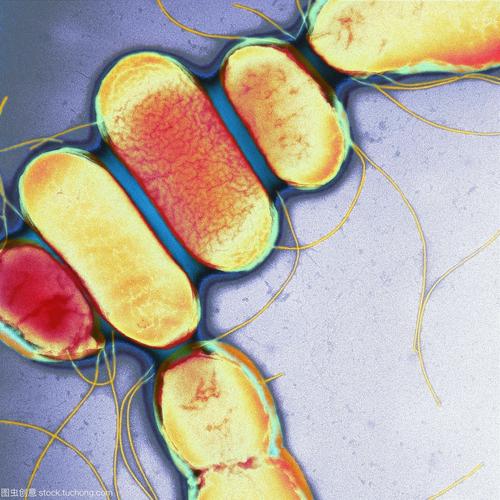 伤寒沙门氏菌_副伤寒沙门氏菌