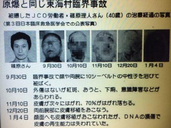日本职员目睹自己83天不断腐烂,求死却遭拒绝|大内|废水|核辐射_新浪