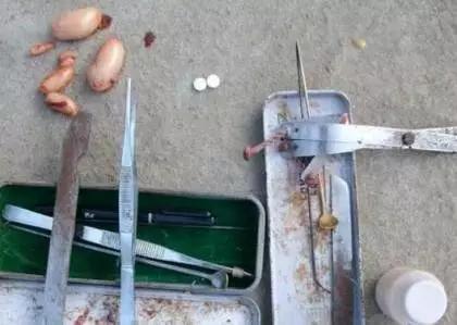 太监阉割全过程,据说不少人看了会疼!