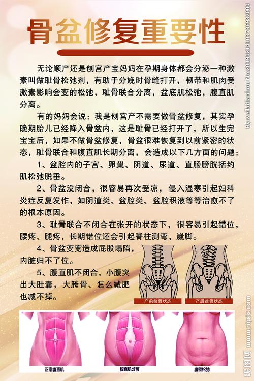 骨盆修复图片