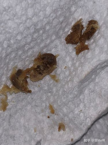 人类需要定时为自己挖耳屎吗?