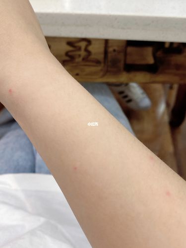 手臂上起了很多这种小红点,不痛不痒的,到底是什么啊