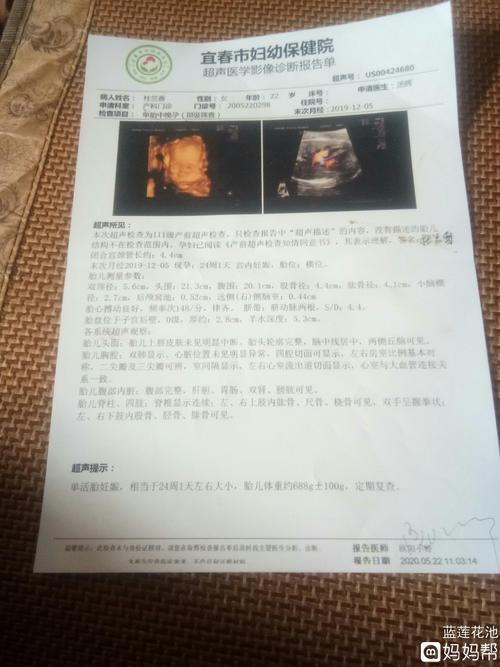 有没有人能看懂四维彩超的,能看出来是男的