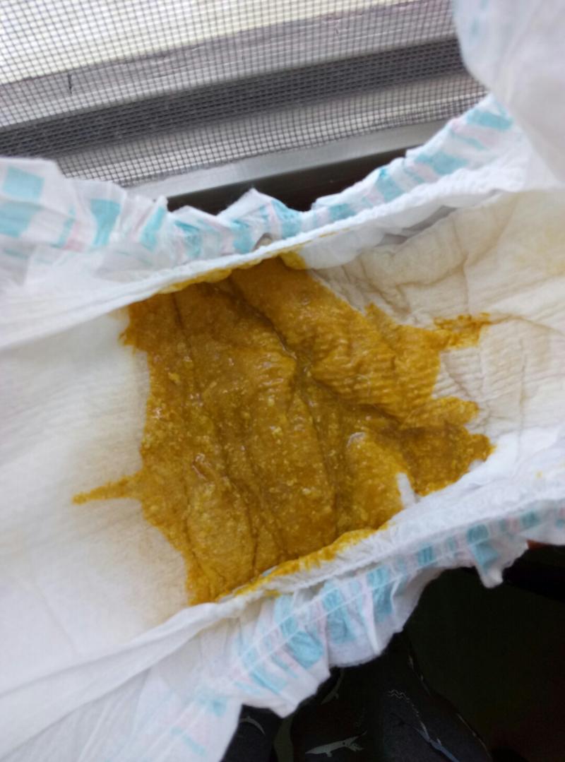 宝宝有一天晚上着凉,第二天就拉肚子了,隔天开始拉带泡沫的粑粑,一天
