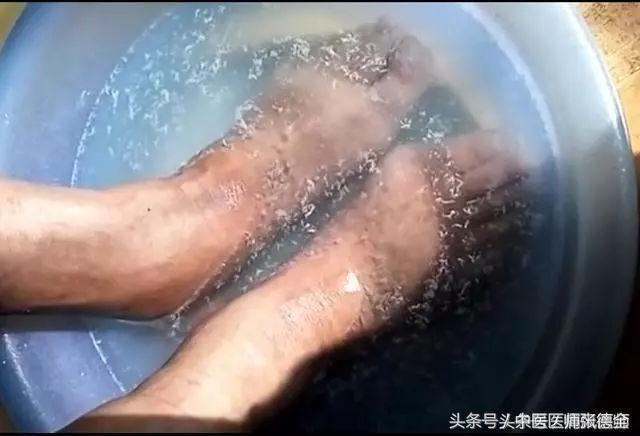 水中漂浮的白色物质为皮肤代谢出来的尿酸盐结晶