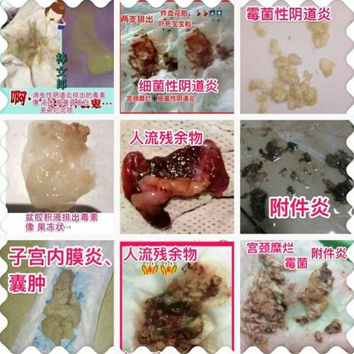 使用棒女郎排出物对照图