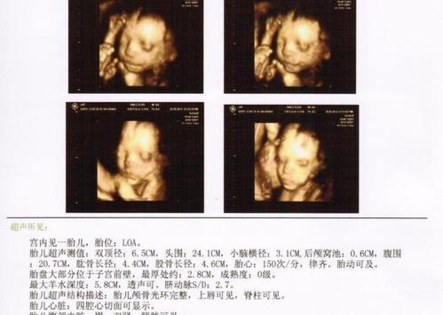 怀孕26周, 四维确认男宝一枚, 给大家分享症状吧