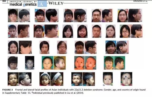在去年这项计划率先实现了应用人脸识别软件对唐氏综合征的诊断.下一