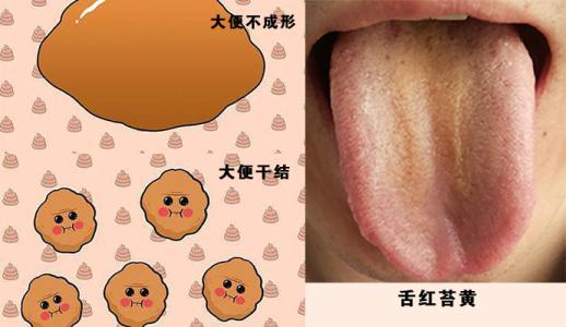 肝胆湿热茶饮有些什么