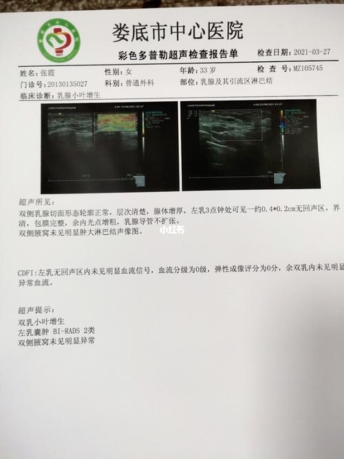 乳腺囊肿_乳腺囊肿_医疗健康_医疗健康其他