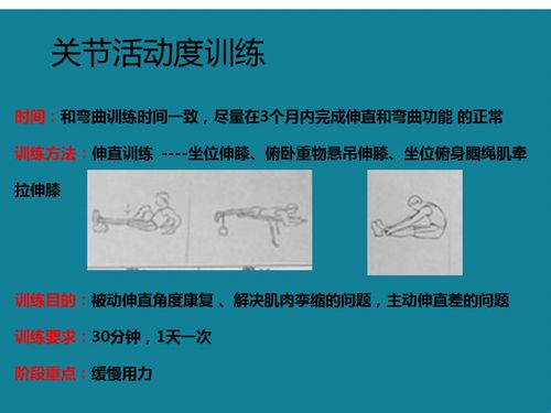 胫骨平台骨折术后康复训练计划