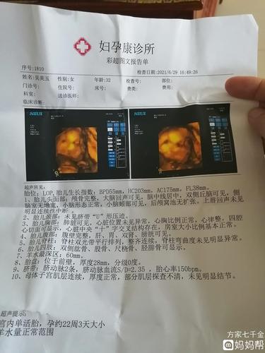 四维彩超通过了;为了要个儿子拼来了七仙女