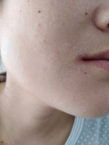 粉底_冬天去哪玩_皮炎_皮肤干燥_美妆_护肤_护肤其他