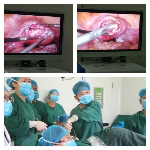 热烈庆祝我院腹腔镜手术迈入一个新台阶