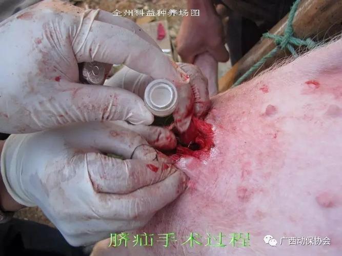 【诊疗】脐疝的治疗(附手术图解)