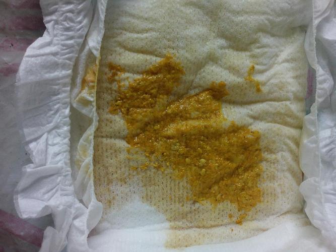 宝宝拉大便这样正常吗?只看楼主