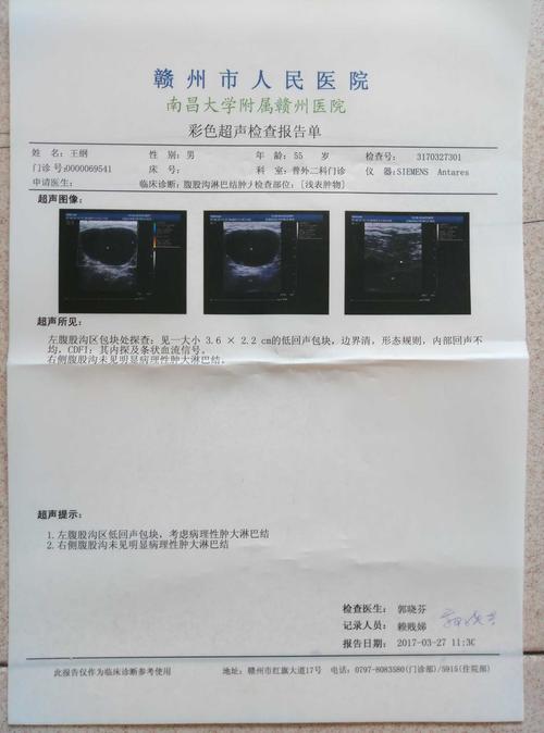 现在这个包已经6cm了,有两张去年3月的穿刺误诊  求求大家现在帮我