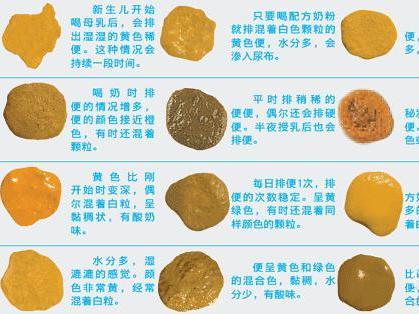宝宝的大便颜色见证着其健康情况,因此许多妈妈都会十分关注宝宝的