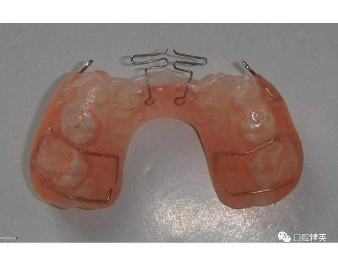 正畸活动矫治器图谱