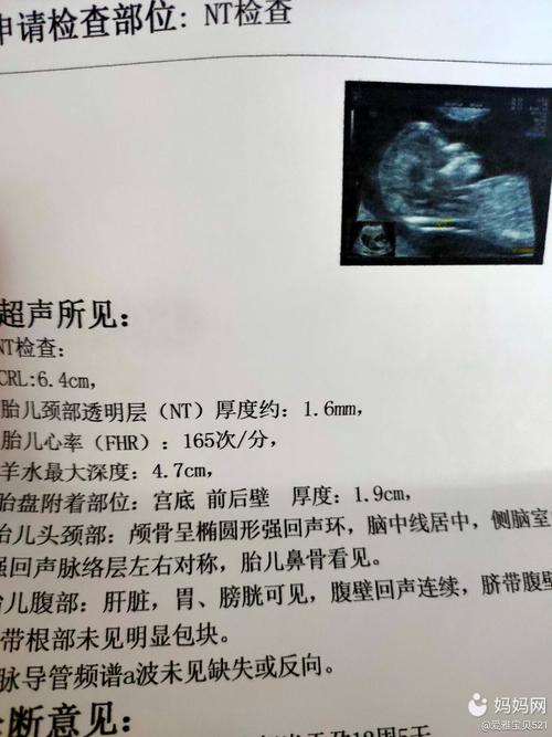 进去彩超检查有10分钟左右,就出来了.