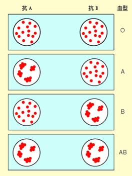 输血与血型 blood transfusion and blood group