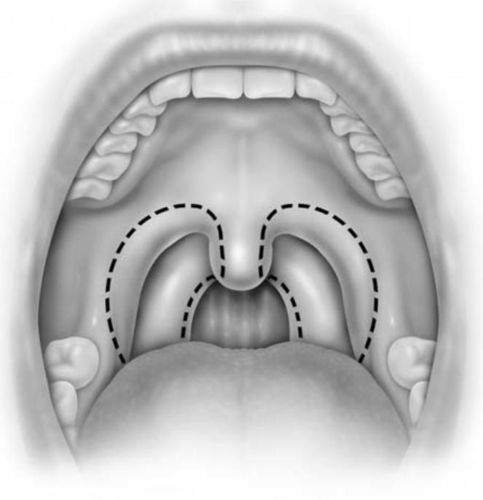 口咽拭子采集流程