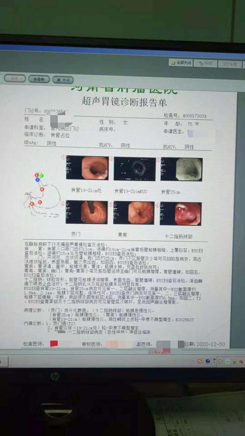 早诊早治驱癌魔,胃镜肠镜显神通——培训有感