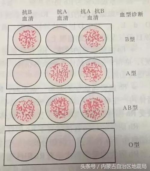 生理学血型的手抄报小学生理财手抄报