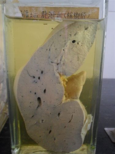 病理学考试标本