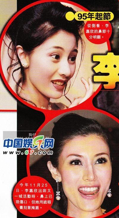 港媒爆李嘉欣为嫁豪门整容:去掉"克夫鼻"