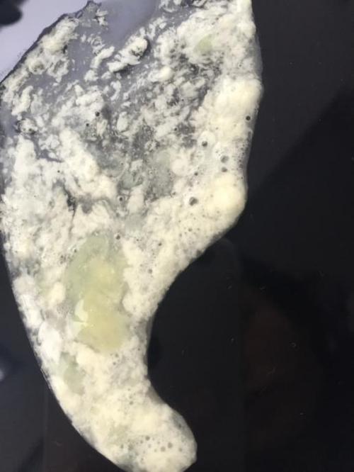帮帮忙看看这中间的那个黄色的是痰吗