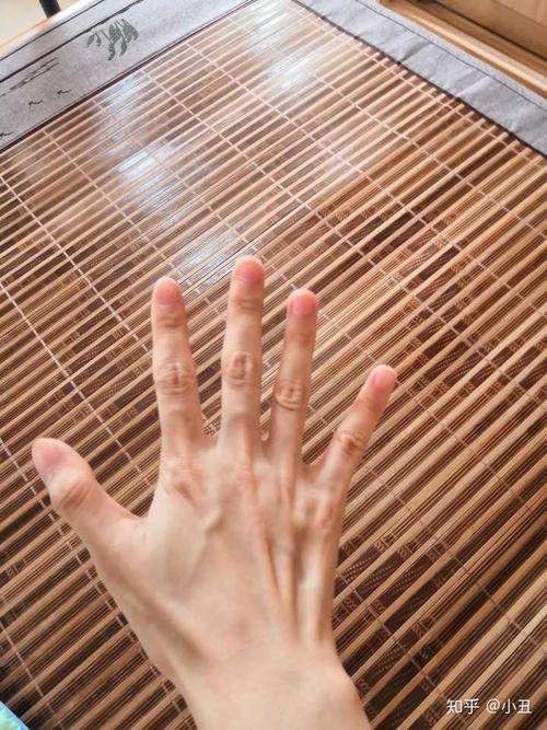 女生的手丑成这样怎么办