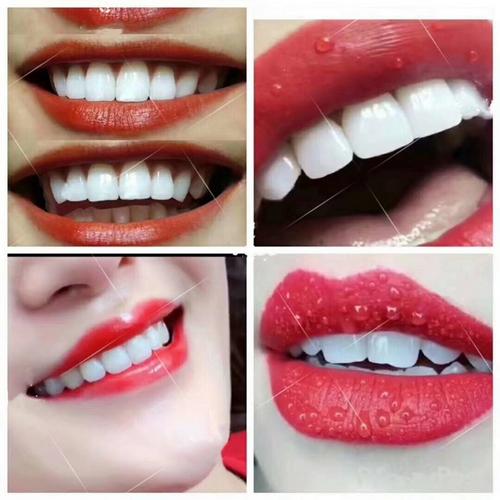 绵阳6d纳米美牙培训多少钱美牙纳米贴面培训