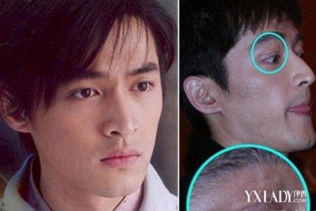 【图】胡歌车祸前后对比图 我并不是靠脸吃饭