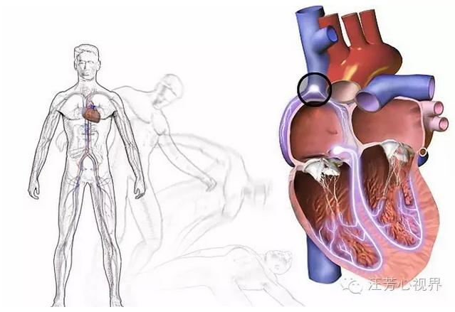 心源性晕厥——让人恐惧的晕厥