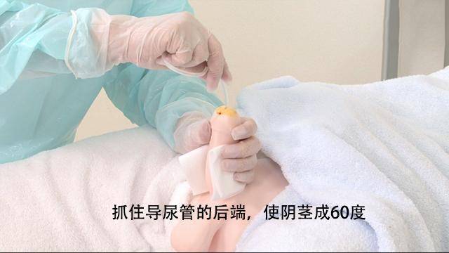 尿管插入后排出1000ml血尿,怎么回事?男性导尿有何技巧?