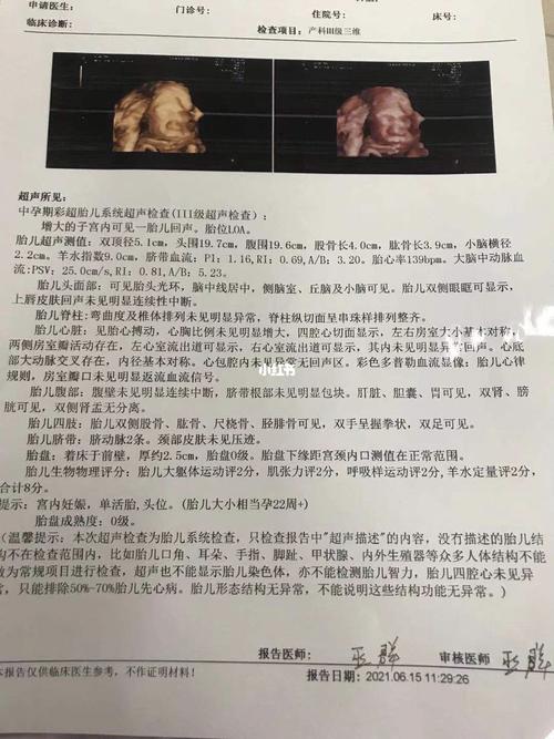 四维顺利完成 女宝宝_女宝宝_四维彩超_母婴_孕产经验