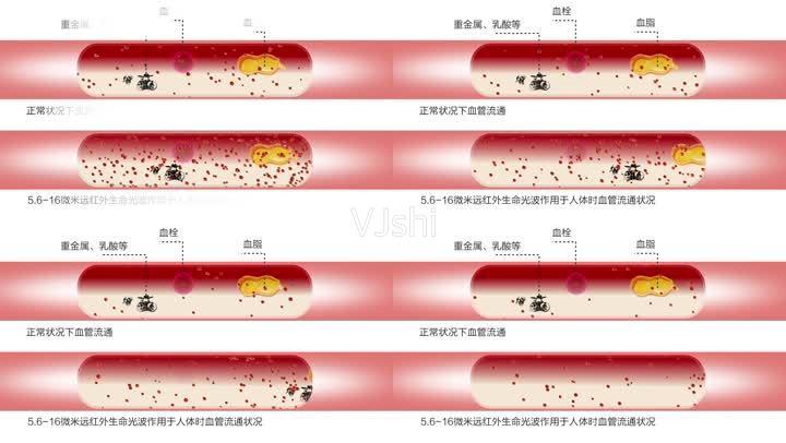 红外微波促进血液流通血液循环