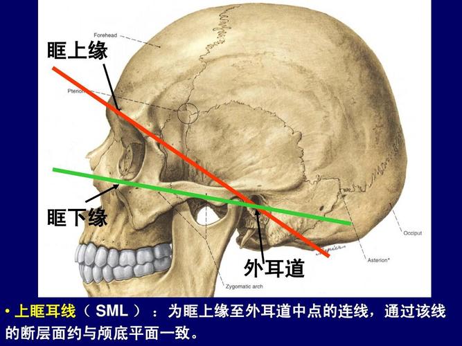 眶耳平面是指