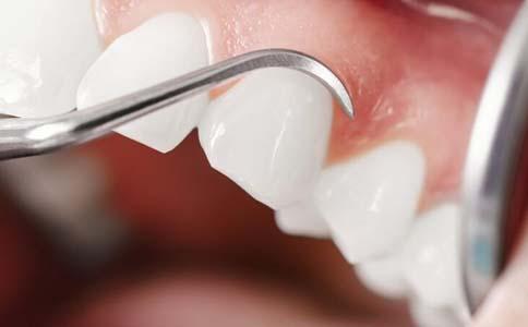 男孩患罕见病 长300颗牙齿