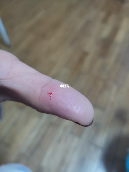 在线等,谢谢各位_疫苗_仓鼠