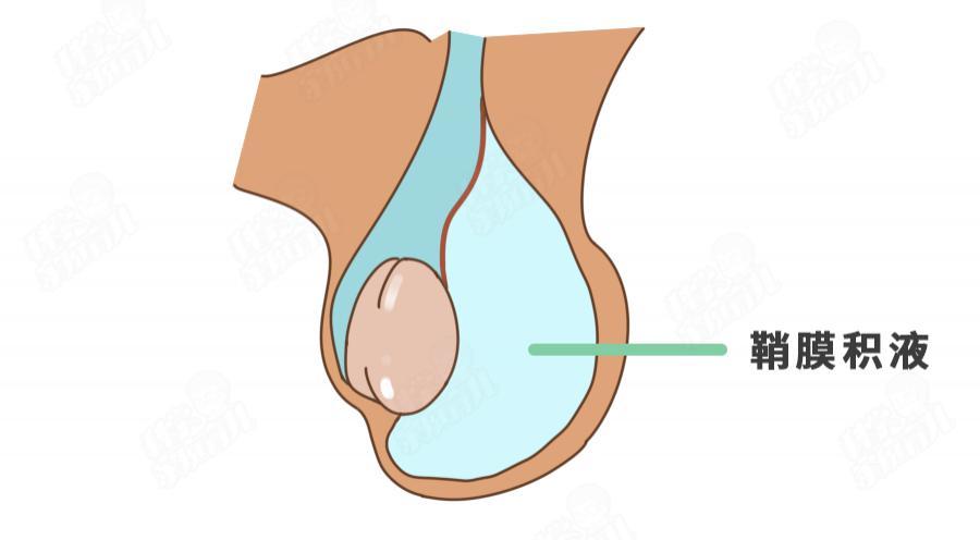 蛋蛋一高一低,一大一小正常吗?男娃5大私处问题,错不起!